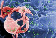 Εντοπίστηκε επικίνδυνη παραλλαγή του ιού του AIDS στην Ευρώπη