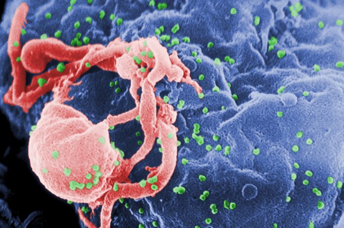 Εντοπίστηκε επικίνδυνη παραλλαγή του ιού του AIDS στην Ευρώπη